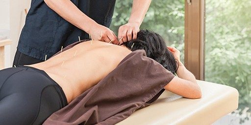 Una mujer joven haciendo terapia de acupuntura